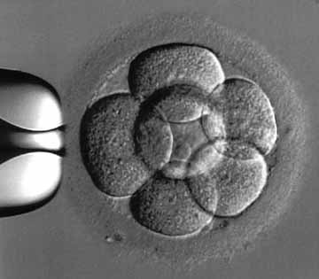 Bay IVF Center photo 3